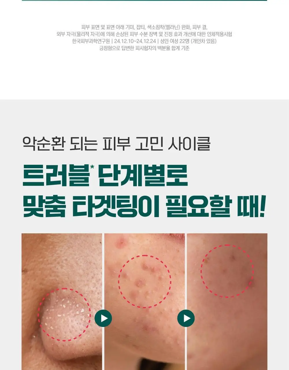 [흔적말끔] 라운드랩 소나무 진정 시카 크림 플러스 60ml 기획 (+토너 20ml) 상세페이지 7